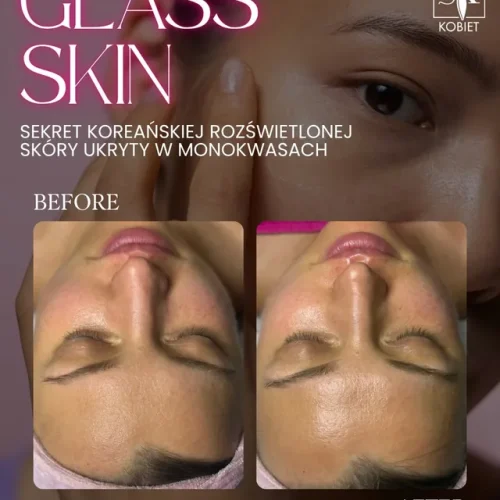 Glass skin
